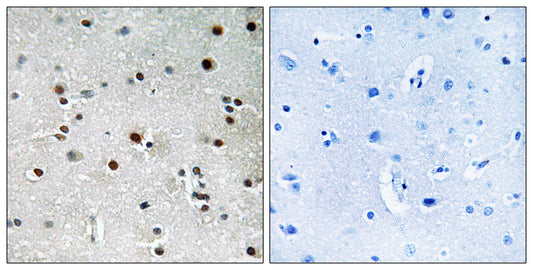 RFX3 Rabbit Polyclonal Antibody