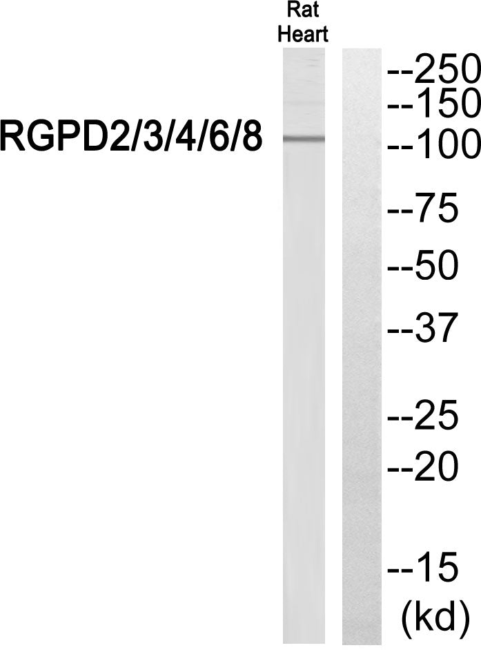 RGPD2/3/4/6/8 Rabbit Polyclonal Antibody