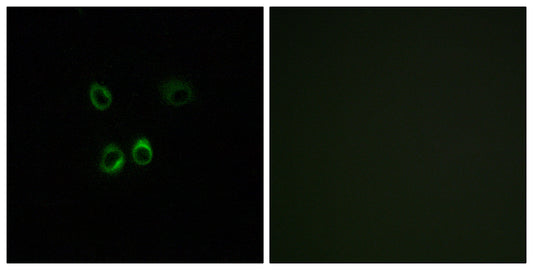RGR Rabbit Polyclonal Antibody