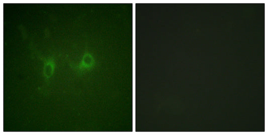RGS16 Rabbit Polyclonal Antibody
