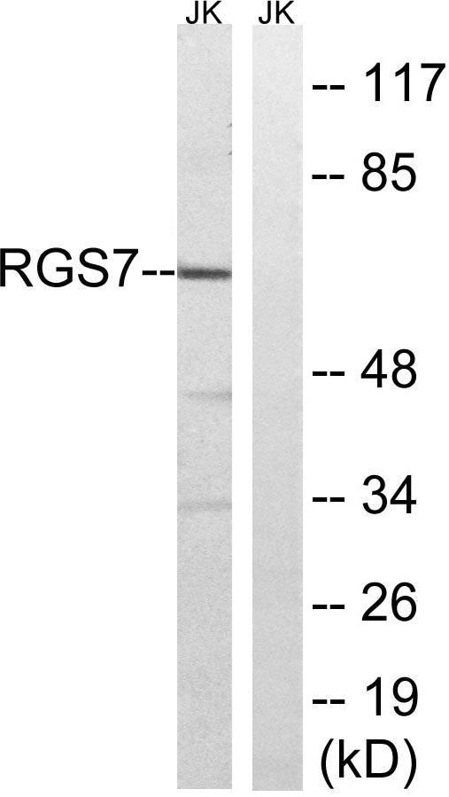 RGS7 Rabbit Polyclonal Antibody