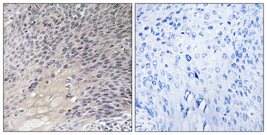 Rho GDIα Rabbit Polyclonal Antibody