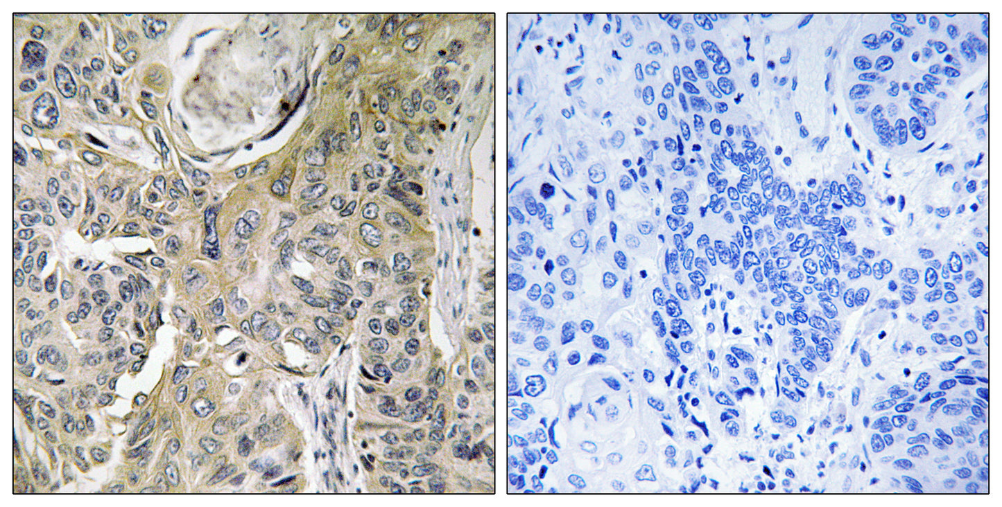 RHOBTB3 Rabbit Polyclonal Antibody
