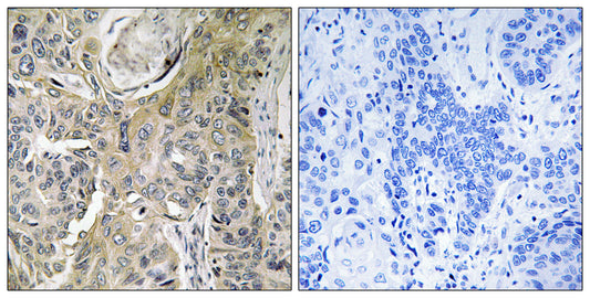 RHOBTB3 Rabbit Polyclonal Antibody
