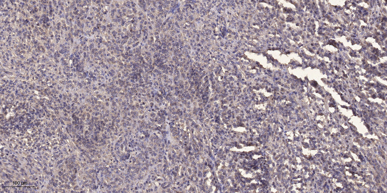 Rhotekin Rabbit Polyclonal Antibody