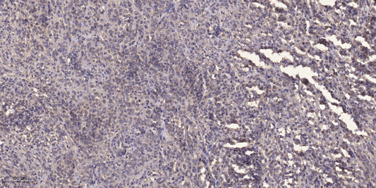 Rhotekin Rabbit Polyclonal Antibody