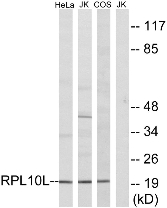 Ribosomal Protein L10L Rabbit Polyclonal Antibody