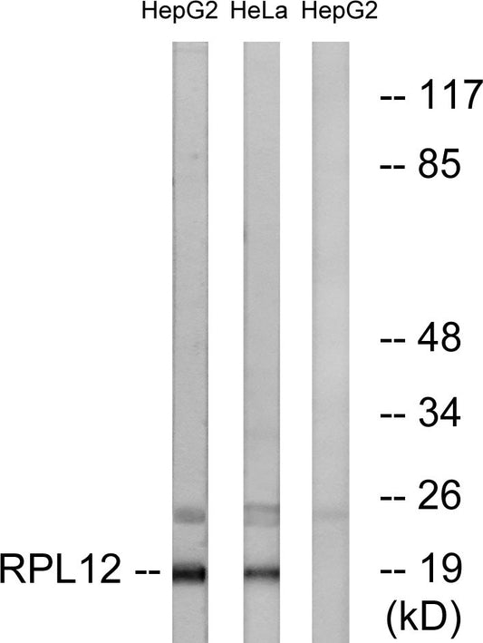 Ribosomal Protein L12 Rabbit Polyclonal Antibody