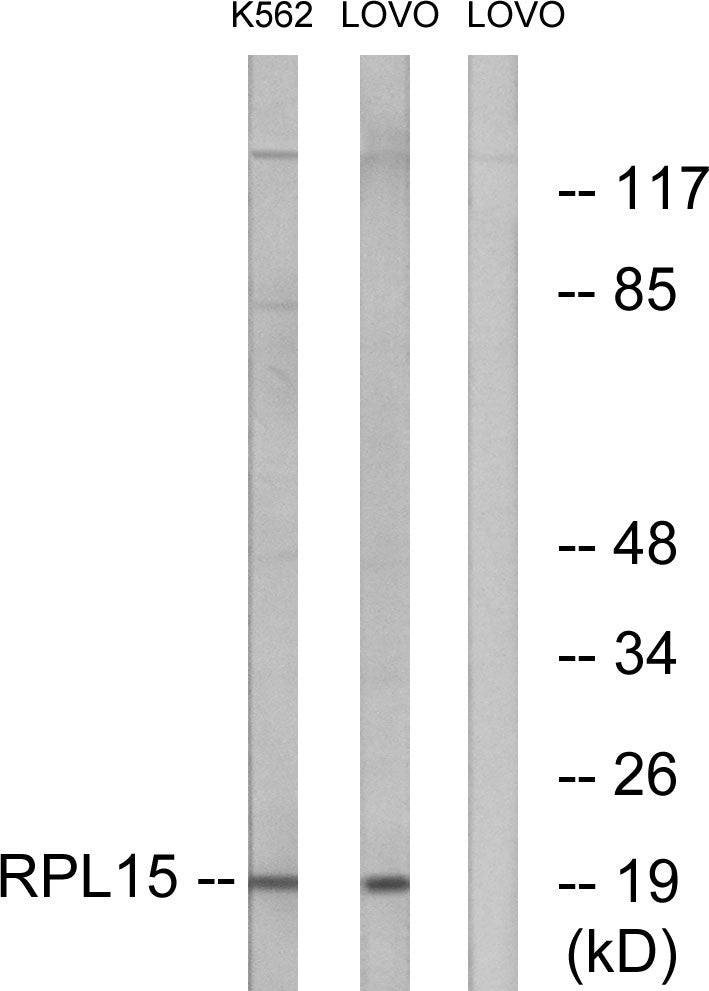 Ribosomal Protein L15 Rabbit Polyclonal Antibody