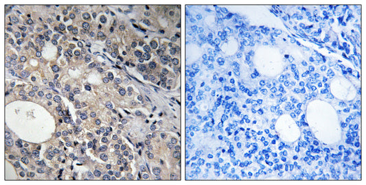 Ribosomal Protein L17 Rabbit Polyclonal Antibody