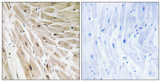 Ribosomal Protein L22 Rabbit Polyclonal Antibody