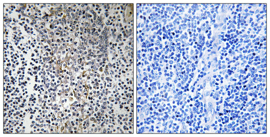 Ribosomal Protein L23 Rabbit Polyclonal Antibody