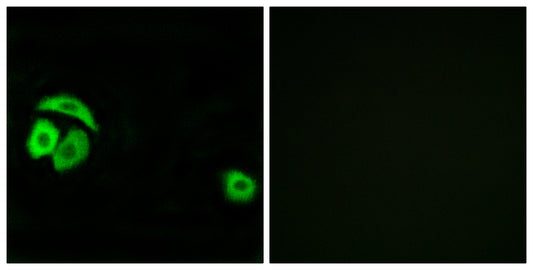 Ribosomal Protein L27A Rabbit Polyclonal Antibody
