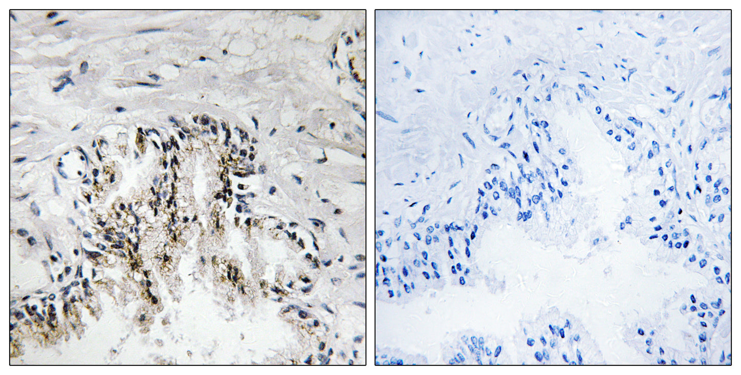 Ribosomal Protein L31 Rabbit Polyclonal Antibody