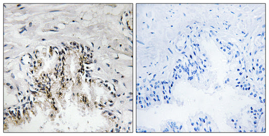Ribosomal Protein L31 Rabbit Polyclonal Antibody
