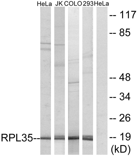 Ribosomal Protein L35 Rabbit Polyclonal Antibody