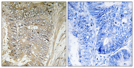 Ribosomal Protein L37A Rabbit Polyclonal Antibody