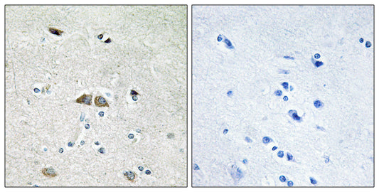 Ribosomal Protein L39L Rabbit Polyclonal Antibody