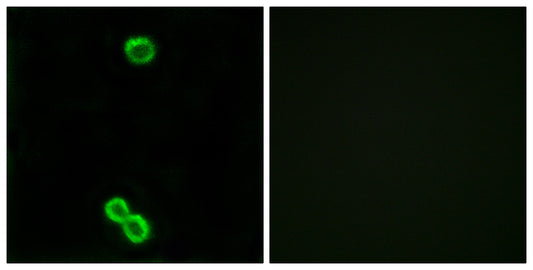 Ribosomal Protein L3L Rabbit Polyclonal Antibody