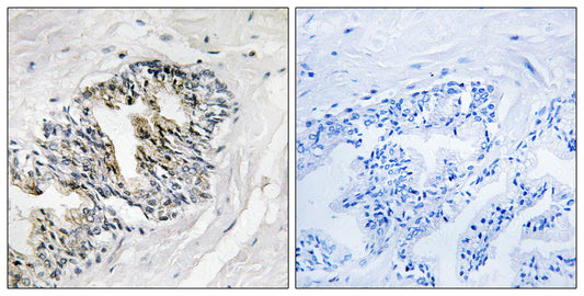 Ribosomal Protein LP2 Rabbit Polyclonal Antibody
