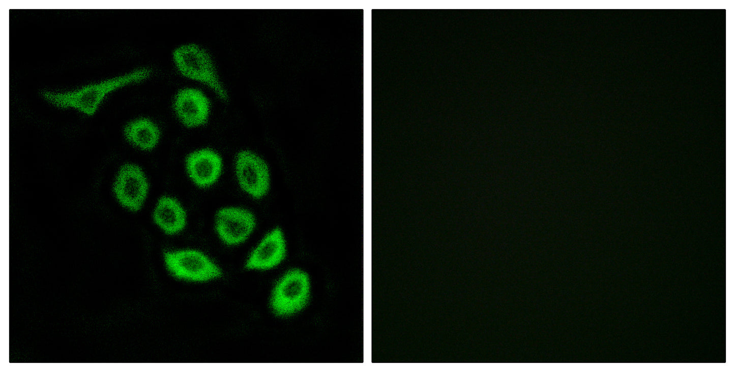 Ribosomal Protein S12 Rabbit Polyclonal Antibody