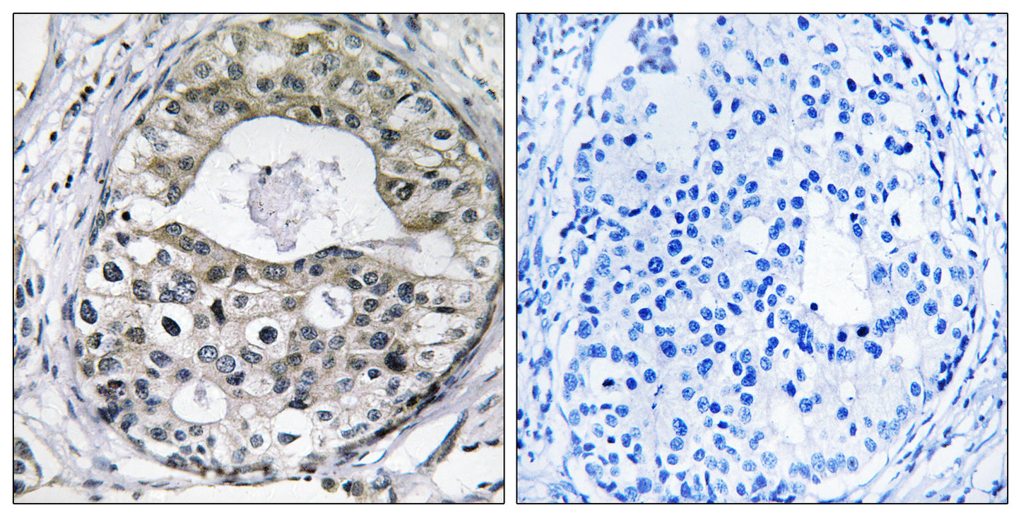 Ribosomal Protein S13 Rabbit Polyclonal Antibody