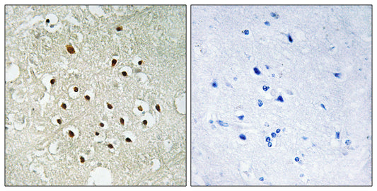 Ribosomal Protein S19BP Rabbit Polyclonal Antibody