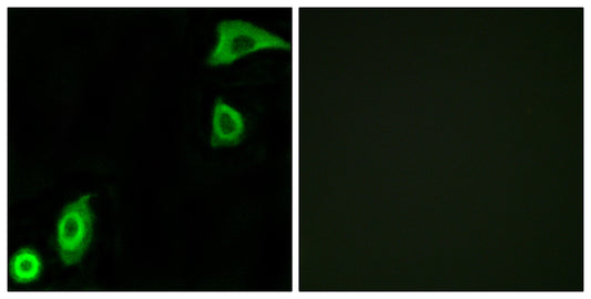 Ribosomal Protein S20 Rabbit Polyclonal Antibody