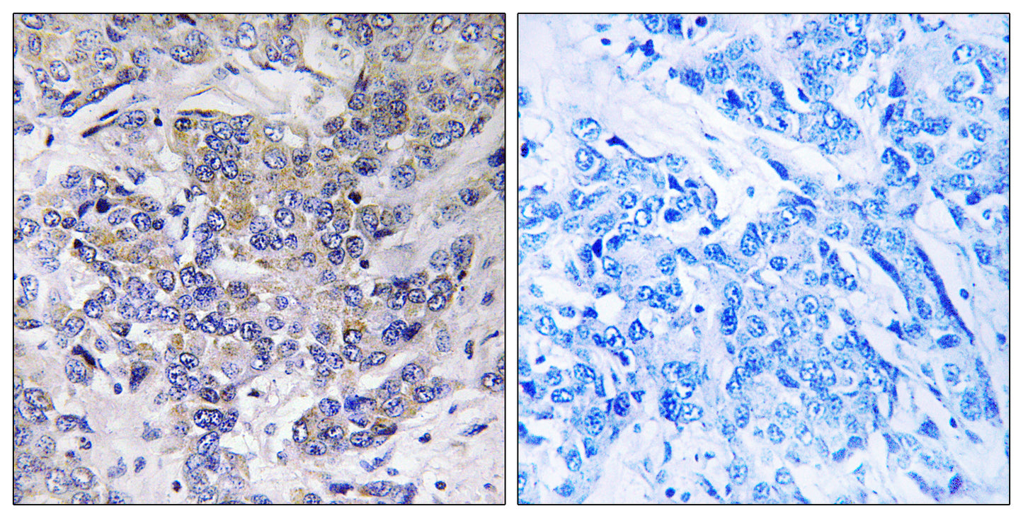 Ribosomal Protein S21 Rabbit Polyclonal Antibody