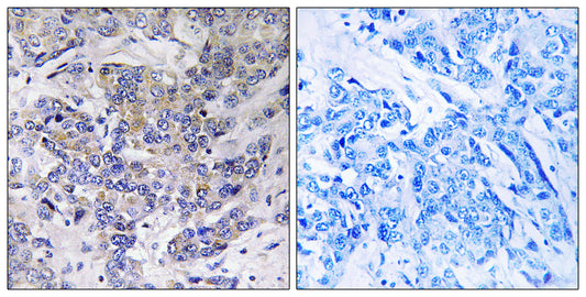 Ribosomal Protein S21 Rabbit Polyclonal Antibody