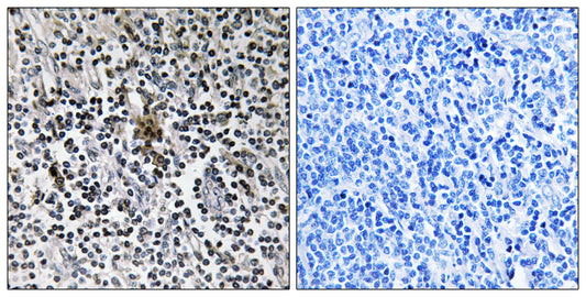 Ribosomal Protein S3 Rabbit Polyclonal Antibody