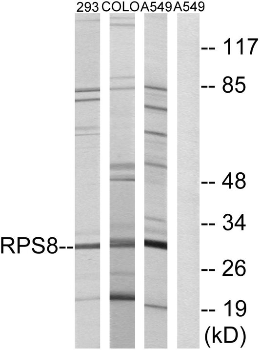 Ribosomal Protein S8 Rabbit Polyclonal Antibody