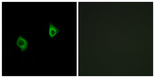 Ribosomal Protein S9 Rabbit Polyclonal Antibody