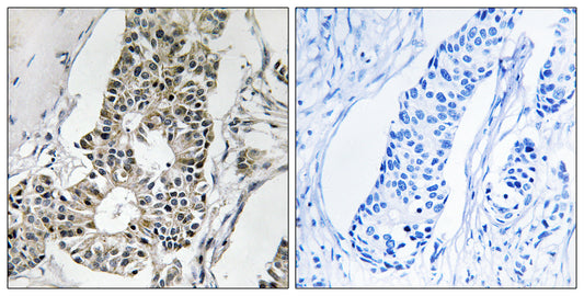 Rim4 Rabbit Polyclonal Antibody