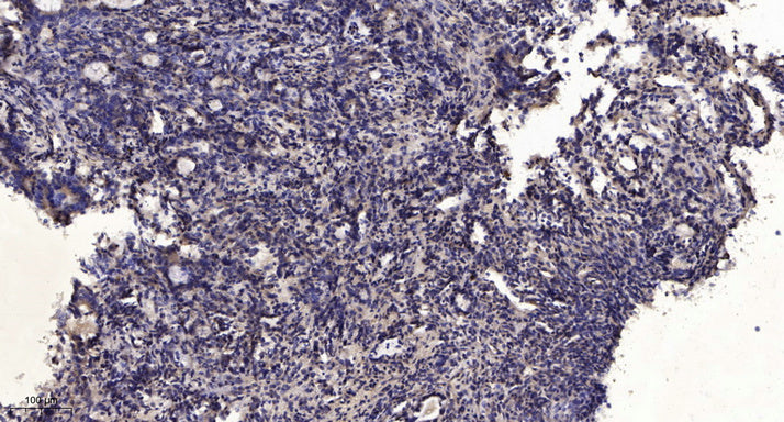 RIOK1 Rabbit Polyclonal Antibody