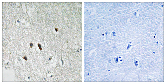 RIP2 Rabbit Polyclonal Antibody
