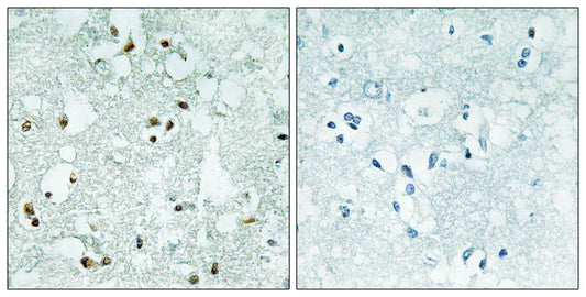 RNase Z2 Rabbit Polyclonal Antibody