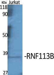 RNF113B Rabbit Polyclonal Antibody