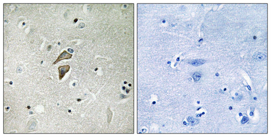 RNF149 Rabbit Polyclonal Antibody