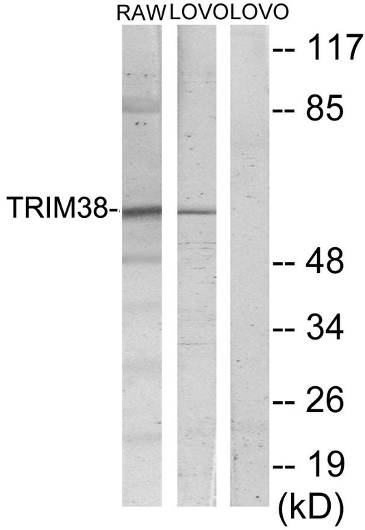 RNF15 Rabbit Polyclonal Antibody