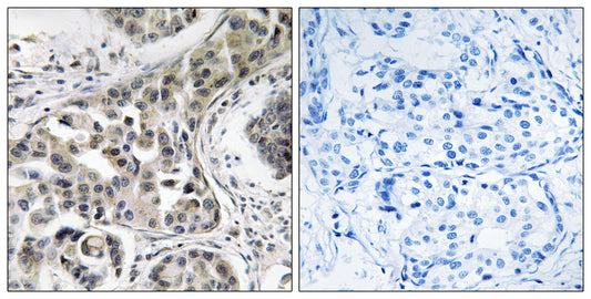 RN-tre Rabbit Polyclonal Antibody