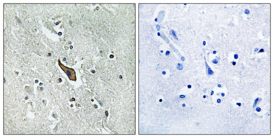 Robo2 Rabbit Polyclonal Antibody