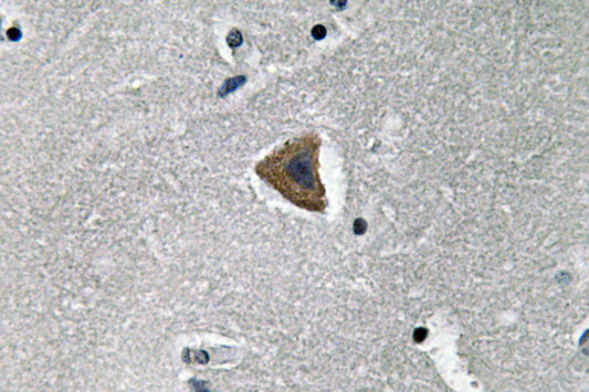 Rock-1 Rabbit Polyclonal Antibody