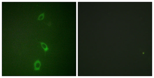 ROM-K Rabbit Polyclonal Antibody
