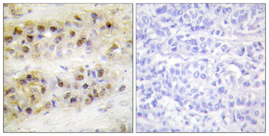 RORα Rabbit Polyclonal Antibody