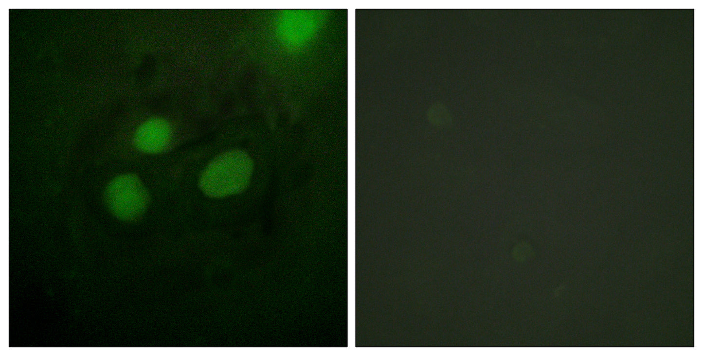 RPA32 Rabbit Polyclonal Antibody
