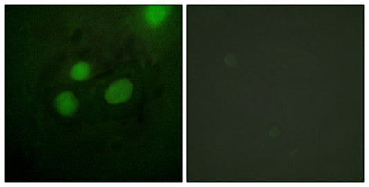 RPA32 Rabbit Polyclonal Antibody