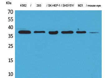 RRP7A Rabbit Polyclonal Antibody