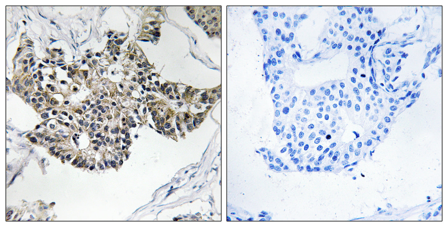 RSAD1 Rabbit Polyclonal Antibody