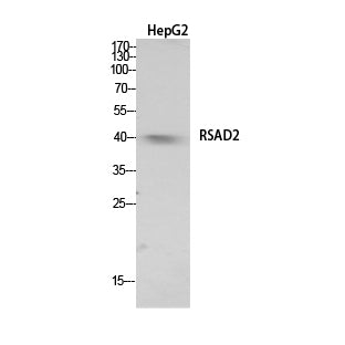 RSAD2 Rabbit Polyclonal Antibody